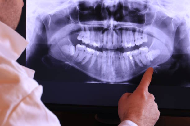 Best Emergency Treatment for Toothache in Inglis, FL