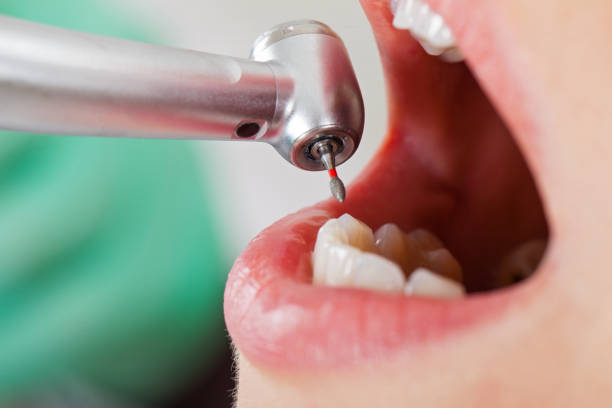 Best Emergency Dental Care for Trauma or Injury in Inglis, FL